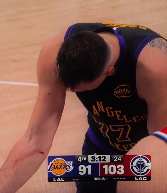 九游娱乐官方-谁抓的~东契奇罚球时看向手臂 好几道伤口&amp;血迹斑斑